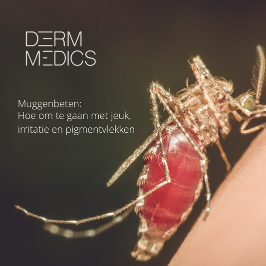 Zo verlicht je jeuk en voorkom je pigmentvlekken na muggenbeten!