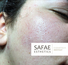 Charger l&#39;image dans la galerie, TCA PEEL SKIN KIT IMPURITIES
