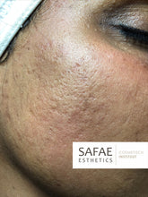 Afbeelding in Gallery-weergave laden, Scarring Fix+ Complete Skin Kit
