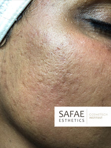 Scarring Fix+ Complete Skin Kit