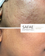 Afbeelding in Gallery-weergave laden, Scarring Fix+ Complete Skin Kit
