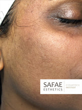 Afbeelding in Gallery-weergave laden, Scarring Fix+ Complete Skin Kit
